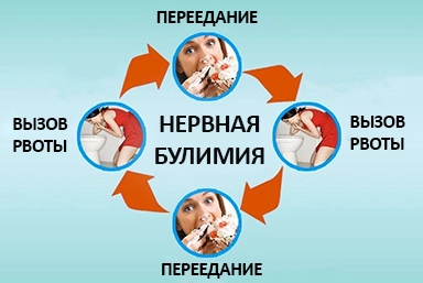 Лечение булимии в Кинели